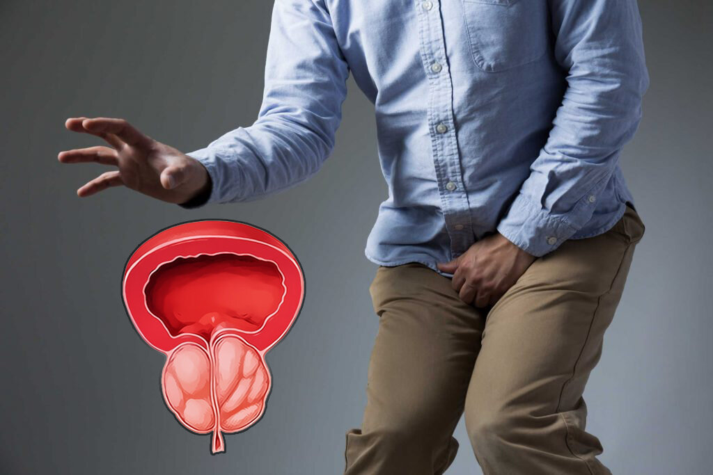 Простатит может быть причина. Простата у мужчин симптомы. Семенной бугорок анатомия. Симптомы простатита у мужчин. Мужские проблемы.